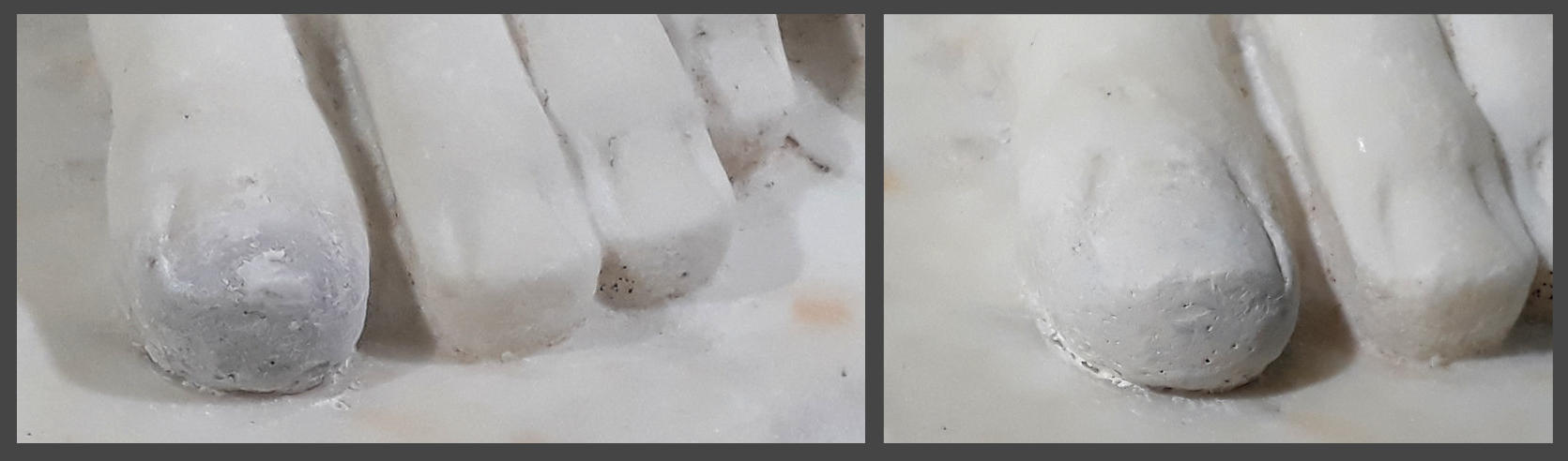 Restauration du bain d'Apollon